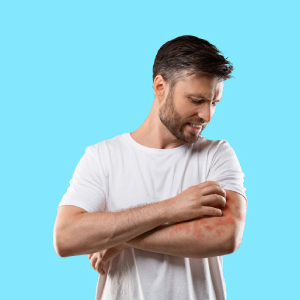 Eczema Treatment and Coping Course