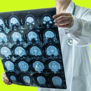 Neurology