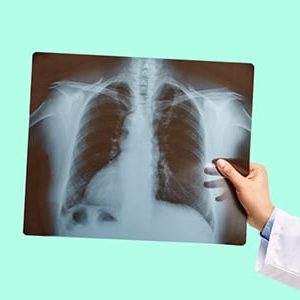 Radiography